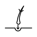 Faza e Implantimit (Faza e Implantimit)
