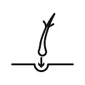 Faza e Implantimit (Faza e Implantimit)